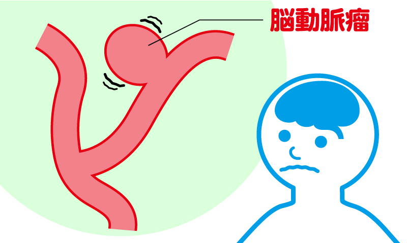 昏睡状態にある動脈瘤の治療法は何ですか?